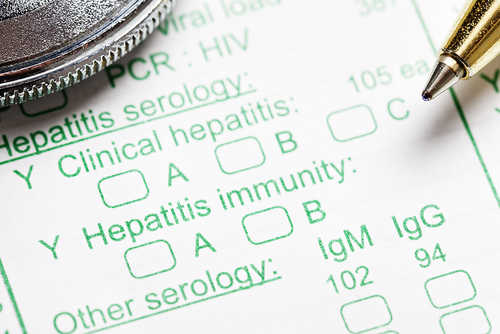 Ribavirin Significantly Improves Results in HCV Patients with Decompensated Liver Disease