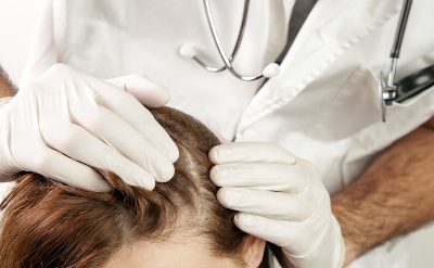 Platelet-Rich Plasma Improves Terminal Hair Density in Women with Androgenic Alopecia